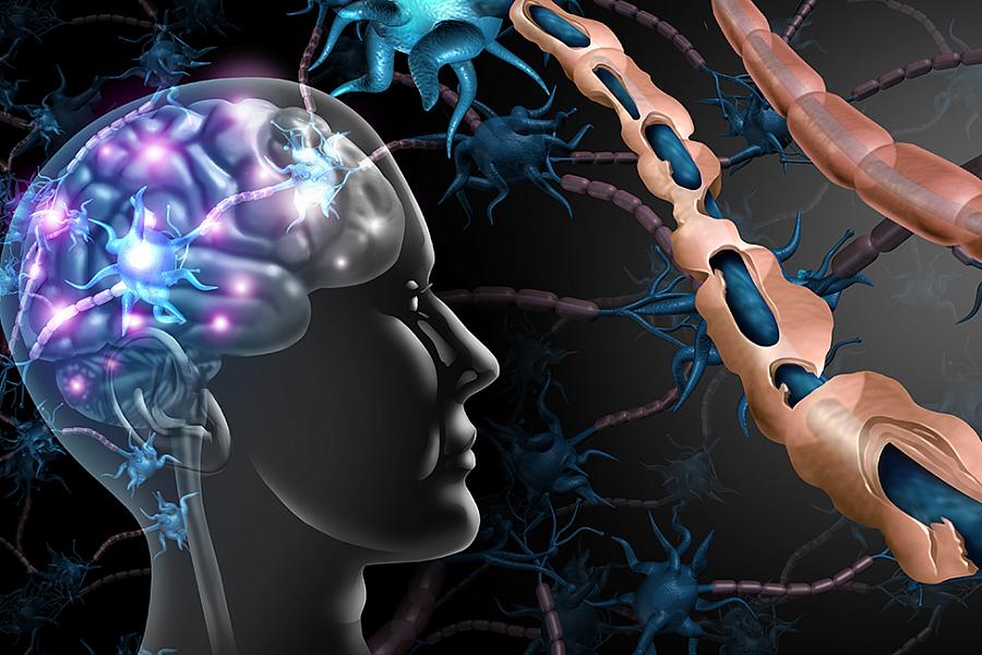 Conceptual brain and neurons image