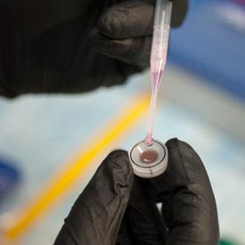 Compared to cells grown in media, RPE cells grown on biodegradable scaffolds develop more like in vivo RPE cells; Bharti’s team then tests the new cells to ensure correct electrophysiological characteristics.