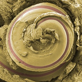 A scanning electron micrograph of the cochlea, a spiral-shaped tunnel in the bony labyrinth of the inner ear