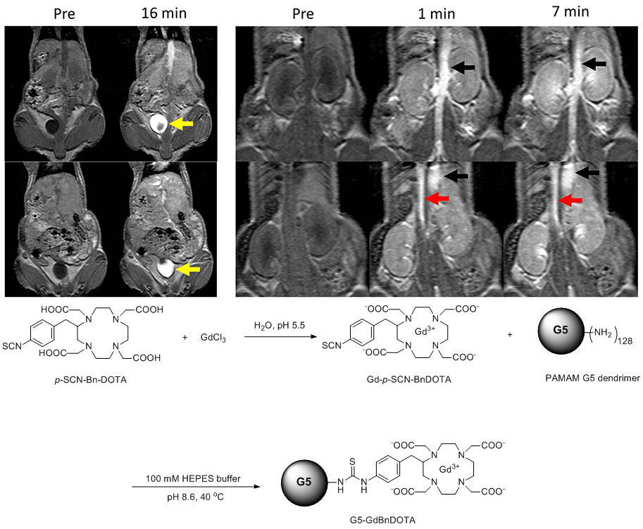 MRI Imaging - Dendrimer