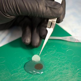 Kapil Bharti’s lab grows retinal pigment epithelium (RPE) cells on a three-dimensional biodegradable scaffold in preparation for clinical implantation trials.