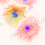 With and without an active centrosome