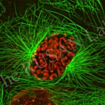 Mammalian cell in prophase