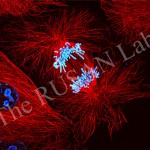 Mammalian cell in anaphase