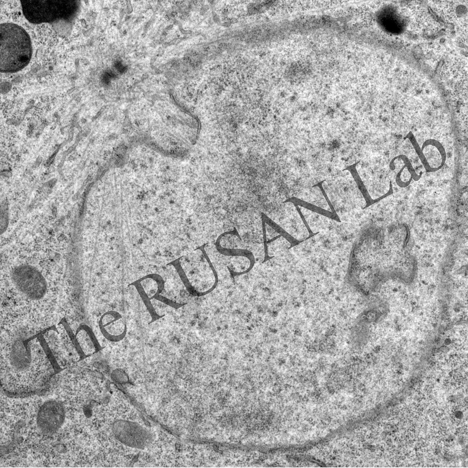 Centrosome microtubules busting through the nuclear envelope