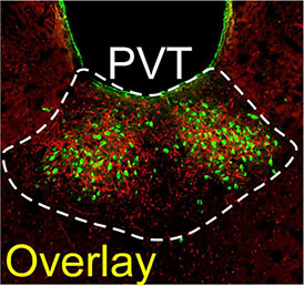 This image of the PVT from Dr. Penzo’s collaborative study with Dr. Buonanno shows dopamine-releasing neuronal projections from the locus coeruleus that end in the PVT (red) and neurons that extend from the PVT to another part of the brain called the nucleus accumbens (green).