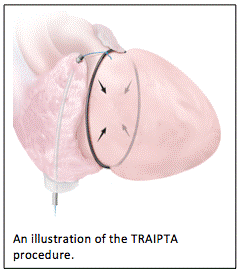 TRAIPTA
