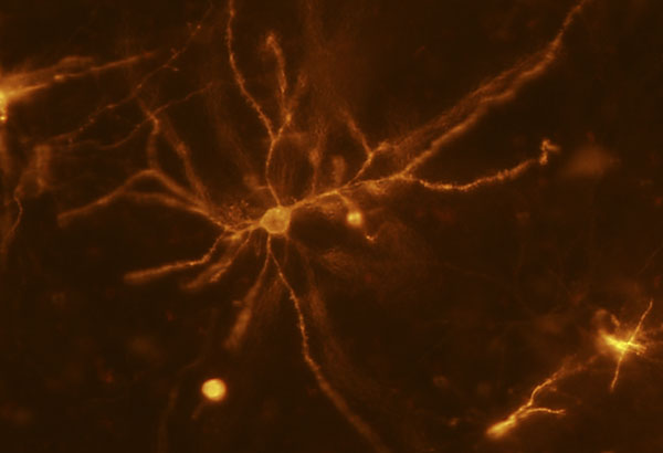 A mouse neuron in the striatum imaged using a two-photon optical microscope allows researchers to measure changes to dendritic spines and their influence on addiction