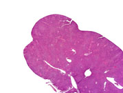 liverpath_a64920r.jpg
