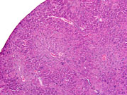 liverpath_a64921r.jpg