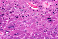 liverpath_a64922r.jpg
