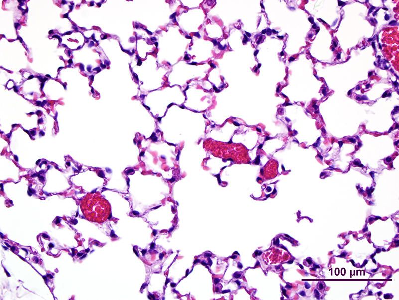 Lung tissue from a normal mouse with open airways (clear spaces) and intact blood vessels (red)