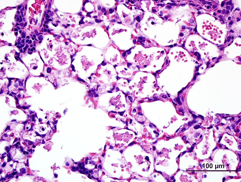 In the absence of immune challenge, lung tissue from mice with macrophages lacking the NELF-B protein reveals signs of inflammation and hemorrhage, suggesting that macrophages lacking NELF activity are hyper-responsive to their environment