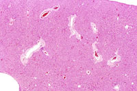 liverpath_amy1.jpg