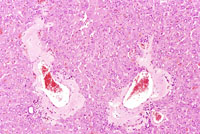 liverpath_amy2.jpg