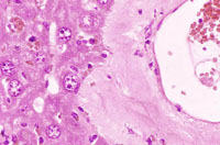 liverpath_amy3.jpg