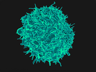 autoimmune_immunotoxicology_.jpg