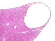liverpath_bdc1.jpg