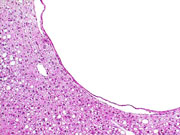 liverpath_bdc2.jpg