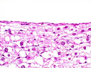 liverpath_bdc3.jpg