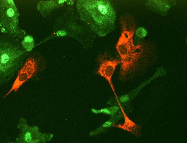 Langat virus infected human dendritic cells, treated with type I interferon and stained for virus (red), and an interferon-induced signaling protein, phosphorylated STAT1 (green); the virus antagonizes interferons’ ability to signal to cells