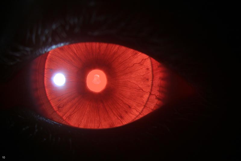 “Red eye” camera-flash reflex: Lotus’ eye shows iris transillumination due to reduced melanin pigment, rather than light passing only through the pupil as in fully-pigmented eyes