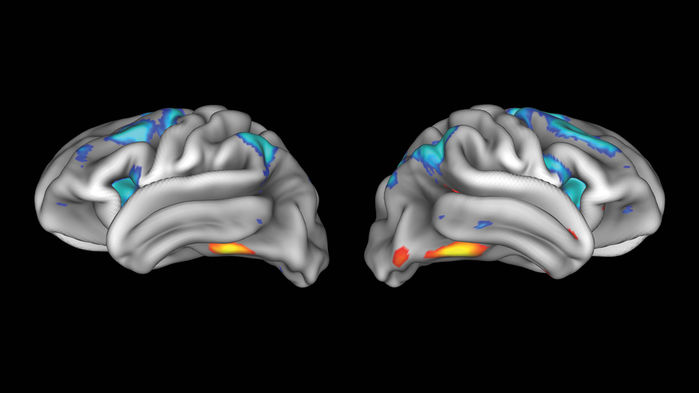 ca_0105nid_brain_online_0.jpg
