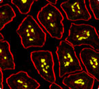 Plasma cells (yellow) from mouse intestinal villi of transgenic mice developed in the Casellas lab
