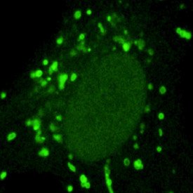 Single cell expressing a fluorescent marker that targets autophagosomes