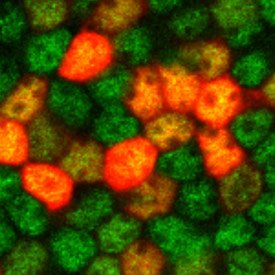 Supporting cells (labeled green with anti-Sox2) infected with adenovirus driving RFP expression (red).
