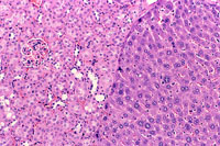 liverpath_ek01.jpg