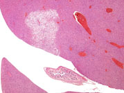 liverpath_ffc01.jpg