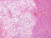 liverpath_ffc02.jpg