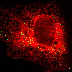 Fluorescent labeling of two organelle systems in a single cell