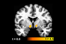 An fMRI image shows the correlation between increased activity in the ventral pallidum region of the brain and the research subjects’ ratings of how pleasant it would be to eat a variety of foods