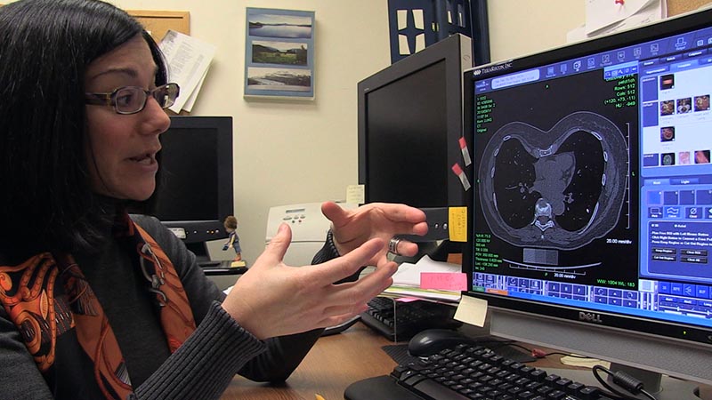 Examining pericardial fat deposits on a CT scan