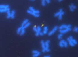 Chromosomes (blue) from a patient with FXS, showing breakage of the FMR1 gene (yellow) at the eponymous fragile site