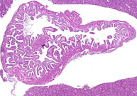 liverpath_gb01.jpg