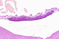 liverpath_gb02.jpg
