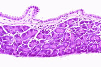 liverpath_gb03.jpg