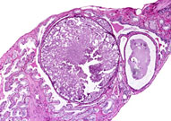 liverpath_gb04.jpg