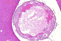 liverpath_gb05.jpg