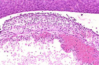 liverpath_gb06.jpg