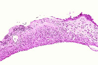 liverpath_gb07.jpg