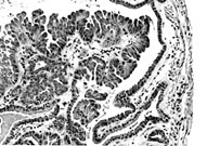 liverpath_gb10.jpg