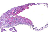 liverpath_gb11.jpg