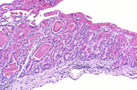 liverpath_gb12.jpg