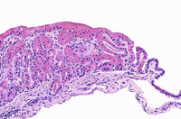 liverpath_gb13.jpg