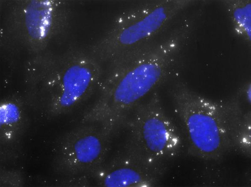 FISH (fluorescence in situ hybridization) of the senescence-associated lncRNA HOTAIR in human diploid fibroblasts