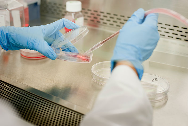 Cultured muscle cells are used to investigate the process of muscle differentiation (myogenesis), which is impaired with advancing age. Studies are underway to investigate age-associated RNA-binding proteins and long noncoding RNAs that influence myogenesis